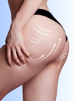 Brazilian Butt Lift
