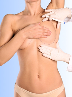 Breast Surgery