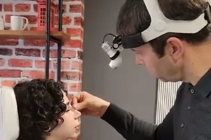 Pre-operative rhinoplasty assessment for a female patient.